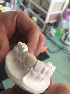 <span class=keywords><strong>Horno</strong></span> de Prensado <span class=keywords><strong>Dental</strong></span> Automático para Bloques de Cerámica IPS E.max, <span class=keywords><strong>Horno</strong></span> de Sinterización para Laboratorio <span class=keywords><strong>Dental</strong></span>, <span class=keywords><strong>Horno</strong></span> de Prensado de <span class=keywords><strong>Porcelana</strong></span> - Product Image 4
