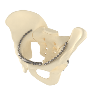 CANWELL CE/ISO gecertificeerde roestvrijstalen orthopedische trauma 3,5 mm bekkenvergrendelingsplaat gebogen botfixatie implantaat anatomisch - Product Image 1