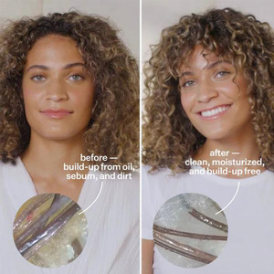 Suero anticaída revitalizante, desintoxicante, suero <span class=keywords><strong>para</strong></span> el <span class=keywords><strong>cabello</strong></span> <span class=keywords><strong>del</strong></span> cuero cabelludo <span class=keywords><strong>para</strong></span> <span class=keywords><strong>cabello</strong></span> áspero y dañado - Product Image 5