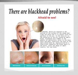 Mascarilla Negra Peel-off Bioaqua de Carbón <span class=keywords><strong>Activado</strong></span> para <span class=keywords><strong>Limpieza</strong></span> de Poros de la Nariz, Marca Privada - Product Image 6