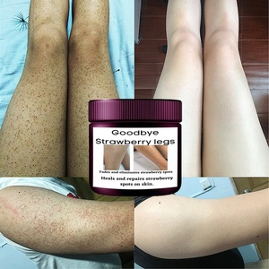 Crème Blanchissante 7 Jours Jambes Fraise Atténue les Taches Peau Lisse Exfoliante - Product Image 1