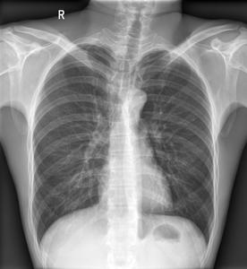 Instruments d'imagerie clinique approvisionnement d'usine Durable 17*17 détecteur sans fil à écran plat alimentation électrique à sortie claire pour les hôpitaux - Product Image 6