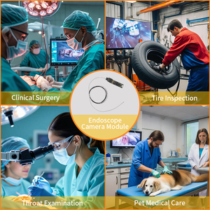 Eจริงใจ0.49MP ที่ดีที่สุด1มิลลิเมตรอุตสาหกรรมการแพทย์ OCHFA20เซ็นเซอร์ CMOS กล้องส่องที่720x720โมดูลกล้อง - Product Image 4