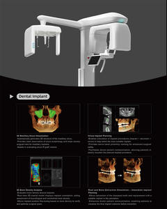 <strong>Dental</strong> Clinic Data Format DICOM 3.0 All-in-One Imaging 16x18 Inch 3D CBCT X-ray with CEPH Electricity Powered CE Certified - Product Image 6