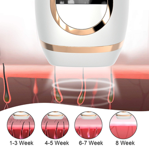IPL Lumière Pulsée Sans Douleur Domestique, Épilateur Portable et Indolore Épilation Permanente, <span class=keywords><strong>Laser</strong></span> d'Épilation à Domicile - Product Image 5