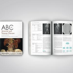 China Factory Custom ized Printing Medizinisches Lehrbuch in Gesundheits-und Krankheits büchern ABC of Arterial and Venous Disease Softcover Book - Product Image 4