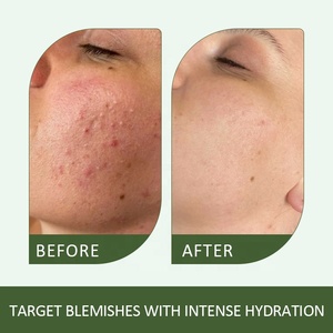 Eau Essentielle Apaisante et Éclaircissante Personnalisée pour Imperfections 130ml, Gel Cica avec Vitamine C & Acide Hyaluronique, Aloe Vera 20g, Soin Quotidien - Product Image 4