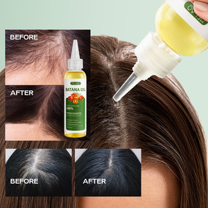 Private Label uomo donna 100% puro capelli naturali cuoio capelluto idratare capelli rafforzamento Batana olio per la crescita dei capelli - Product Image 5