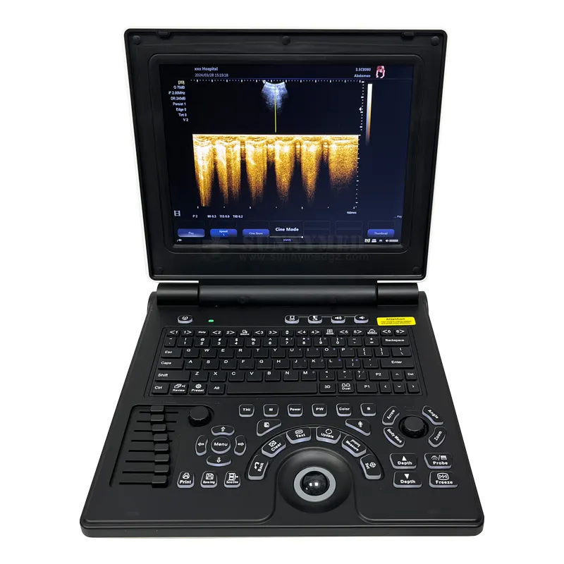 SY-A020E harga pabrik laptop warna doppler 3D pemindai ultrasound untuk penggunaan dokter hewan