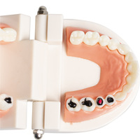 DM Dental Tooth Gems modelo educativo médico-paciente caries modelo de exhibición dentista enseñanza estudio