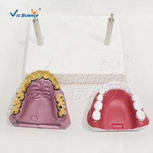 Modelo Educativo Dental: Comparación de Dientes Saludables y Dientes de Fumador - Product Image 3