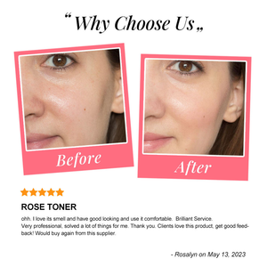 Agua de Rosas Pura, Orgánica y Natural, Hidratante de Lujo a Base de Hierbas, Tónico Facial en <span class=keywords><strong>Spray</strong></span>, Marca Privada - Product Image 2