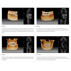 Macchina CBCT Digitale 3D Panoramica per Dentisti, Usata, Vatech Cone-beam-ct-machine - Product Image 3