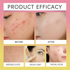 Jaysuing 55 piezas cúrcuma Ácido Kójico almohadillas <span class=keywords><strong>de</strong></span> limpieza <span class=keywords><strong>lavado</strong></span> <span class=keywords><strong>de</strong></span> cara exfoliante brillo acné reducción 60 piezas almohadillas <span class=keywords><strong>de</strong></span> limpieza para la cara - Product Image 2