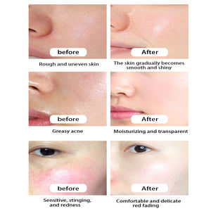 Kit de Productos Coreanos para el Cuidado de la Piel OEM ODM, Cosméticos Orgánicos Faciales Hidratantes y Blanqueadores, Set de Cuidado <span class=keywords><strong>Facial</strong></span> de Arroz para Mujeres - Product Image 3