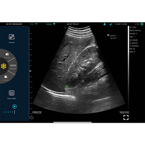 Teléfono inteligente/ordenador Android conectar sonda USB inalámbrica de mano ultrasonido inalámbrico Konted MDR - Product Image 4