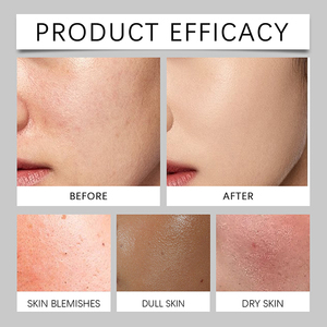 Crème <span class=keywords><strong>Visage</strong></span> Hydratante Bio <span class=keywords><strong>pour</strong></span> Hommes à l'Extrait de Purslane et de Menthe Poivrée Apaisante <span class=keywords><strong>Anti</strong></span>-Rougeurs Crème de Maquillage <span class=keywords><strong>pour</strong></span> Hommes - Product Image 5