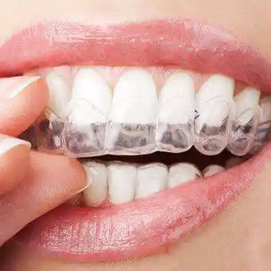 OEM Logo privato personalizzato chiaro allineamenti denti ortodontico denti denti bretelle raddrizzamento bretelle - Product Image 2
