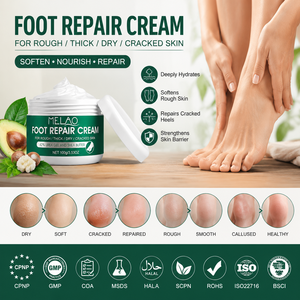 MELAO Best Sellers Crème à l'urée pour les <span class=keywords><strong>pieds</strong></span>, soin des <span class=keywords><strong>pieds</strong></span>, crème réparatrice pour les <span class=keywords><strong>pieds</strong></span> secs, rugueux, épais, fissurés, callosités, crème pour les <span class=keywords><strong>pieds</strong></span> à l'urée - Product Image 1