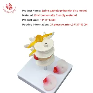 Modello di patologia della colonna lombare FRT038 Herniat disk modello patologico della Vertebra lombare umana - Product Image 5
