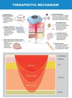 Thérapie par la lumière infrarouge rouge portable avec 808 chien d'équipement vétérinaire de thérapie au laser de classe iv laser