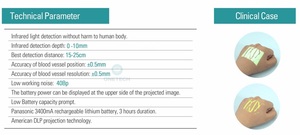 Vf12 Vf12 Nhi Dành Cho Người Lớn Tĩnh Mạch Định Vị Tĩnh Mạch Chiếu, Di Động Hồng Ngoại Tĩnh Mạch Finder, Di Động Tĩnh Mạch Finder - Product Image 6