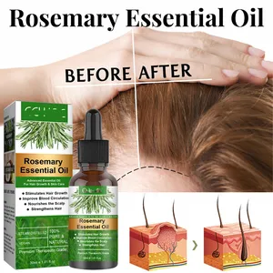 Olio essenziale di rosmarino siero per donne nere Private Label trattamento dei capelli olio per la crescita dei capelli calvi prodotto olio