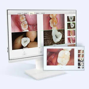 Meilleure caméra intra-orale dentisterie endoscope dentaire caméra intra-orale cam moniteur tout en un