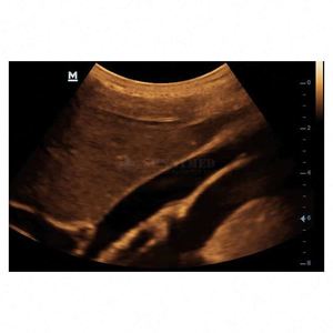 Mesin USG Portabel Veteriner <span class=keywords><strong>Mindray</strong></span>, Mesin USG <span class=keywords><strong>Mindray</strong></span> <span class=keywords><strong>DP</strong></span>-<span class=keywords><strong>10</strong></span> - Product Image 3