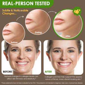 Acentiallabs toptan Transdermal yamalar Paraben ücretsiz kollajen yamalar kollajen peptidler kollajen yamalar cilt saç için - Product Image 4