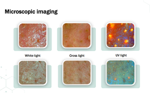 Machine d'analyse cutanée IA X5Pro, 36 millions de pixels, détection des problèmes de peau, analyse de l'hydratation et de l'acné de tous les types de peau - Product Image 4