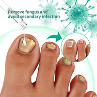Essence de traitement de haute qualité, solution de réparation des ongles, sérum de réparation des ongles, vernis à ongles