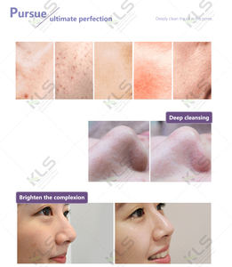 Solución de Suero Líquido, Consejos para la Máquina Facial Hydra Beauty - Product Image 2