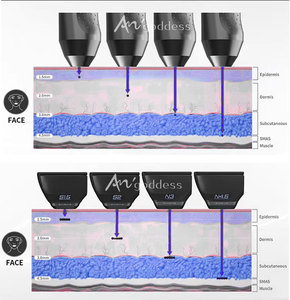 Cartouches Consommables Remplaçables pour Appareil de Beauté Collagen Cannon – Équipement de Salon de Bien-être pour Lifting Facial et Activation Cellulaire (OEM) - Product Image 2