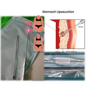 Mesin Laser penghilang Nadi wajah portabel, pencari Nadi wajah 980Nm, lipolisasi, mesin penghilang pembuluh darah, produk baru untuk penggunaan kecantikan - Product Image 5