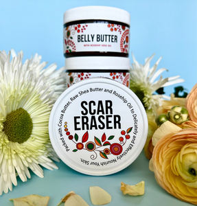 OEM Scar Eraser จางหายไปรอยแผล<span class=keywords><strong>เป็น</strong></span>จากสิวรอยขีดข่วนและรอยแตกลาย | 100% Butters และ Oil สูตรด้วยเนยโกโก้ - Product Image 2