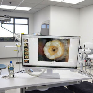 Strumento Elettrico Digitale per Micro-Osservazione Intraorale di Alta Qualità all'Ingrosso Accessorio Dentale Orale - Product Image 2