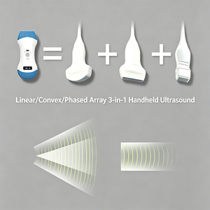 Escáner de ultrasonido inalámbrico portátil con punto de acceso Wifi integrado, sin cable, para recorridos por la sala de enfermería, sala de emergencias, escaneo corporal clínico - Product Image 2