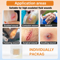 Pansement en mousse de silicone de qualité médicale 4 x 4 pouces, bordure en silicone douce, imperméable, haute absorption, stérilisé à l'oxyde d'éthylène, pour soins des plaies