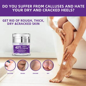 Crema para Pies con 40% de Urea, Suavizante e Hidratante, Elimina Callosidades <span class=keywords><strong>y</strong></span> Piel Muerta, para Pies, <span class=keywords><strong>Codos</strong></span> <span class=keywords><strong>y</strong></span> Manos -281410 - Product Image 3