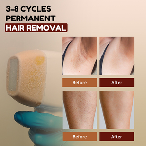 <span class=keywords><strong>เครื่อง</strong></span>กำจัดขนเลเซอร์ IPL พร้อมเครื่องฟื้นฟูผิวหัว Microneedle RF เศษส่วน <span class=keywords><strong>HIFU</strong></span> กระชับช่องคลอด - Product Image 5