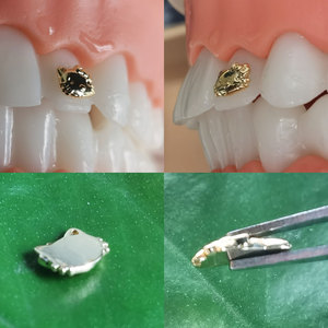 ZZSU Teeth Gems 8K Gold Copper Alloy Kitty Shape Grillz Jewelry Teeth Decoration for Home Use - Product Image 3