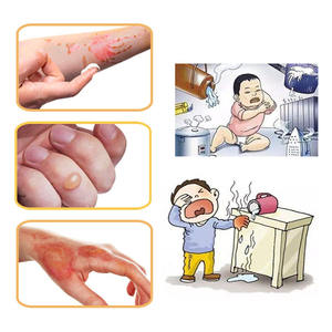 Crème de soin des brûlures South Moon 20g en gros, absorption rapide, soulage la douleur et la sensation de brûlure, sans odeur irritante - Product Image 4