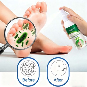 Spray Natural Antifúngico para Pies con Botánicos - Elimina Eficazmente los Hongos, Detiene <span class=keywords><strong>la</strong></span> Picazón y Refresca <span class=keywords><strong>la</strong></span> <span class=keywords><strong>Piel</strong></span> Sin Productos Químicos Agresivos - Product Image 5