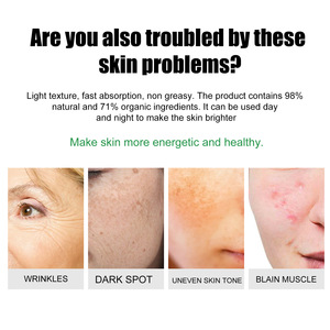 Eelhoe ครีมซ่อมแซมการดูแลผิวที่เป็น<span class=keywords><strong>สิว</strong></span>ทำให้ผิวกระจ่างใส - Product Image 4