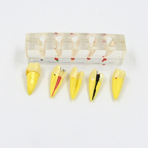 Chambre à pulpe amovible et système de <span class=keywords><strong>canal</strong></span> radiculaire pour la pratique de la pathologie de l'école dentaire avec modules de lésion périapicale - Product Image 6