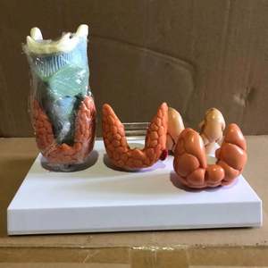 Патологическая модель щитовидной железы - Product Image 6