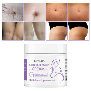 Krim Penghilang Stretch Mark, Krim Penghilang Stretch Mark Melar Kulit Organik Alami - Product Image 2