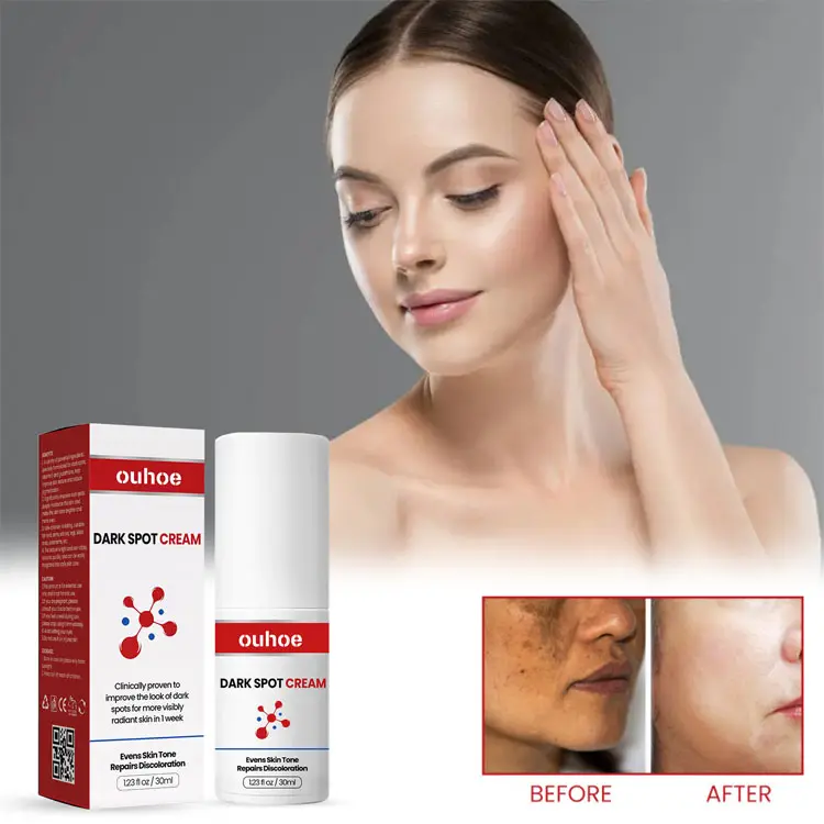 Hochwertige entfernen dunkle Flecken Reparatur Haut verblassen Melanin Melasma Entfernung Aufhellen Anti-Aging White ning Sommersprossen creme