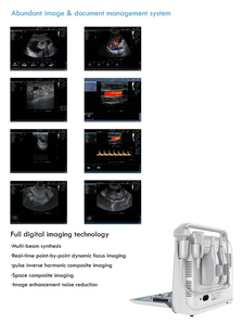 Sistema de Diagnóstico por Ultrasonido Doppler Color Digital Portátil Veterinario Médico Profesional Modelo TH300 Acero Inoxidable ISO13485 - Product Image 4